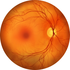 정상 망막
