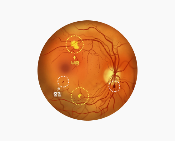 비증식성 이미지