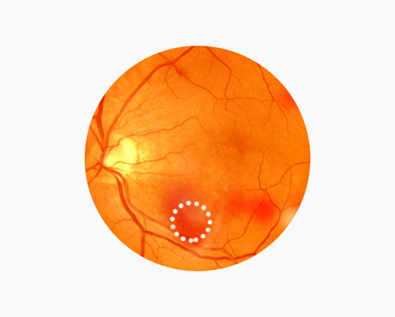 비증식성 이미지