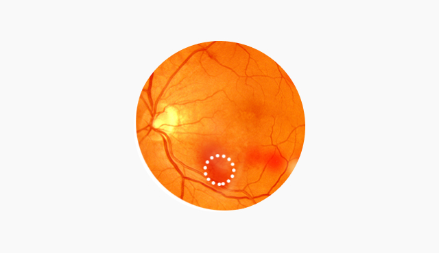 비증식성 이미지